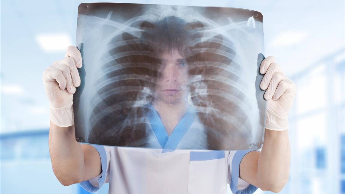 Szpital w Dąbrowie Białostockiej będzie miał mobilny aparat RTG