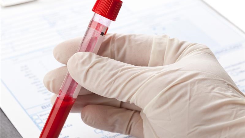 Kończą się zapasy krwi w białostockiej klinice onkologii DSK