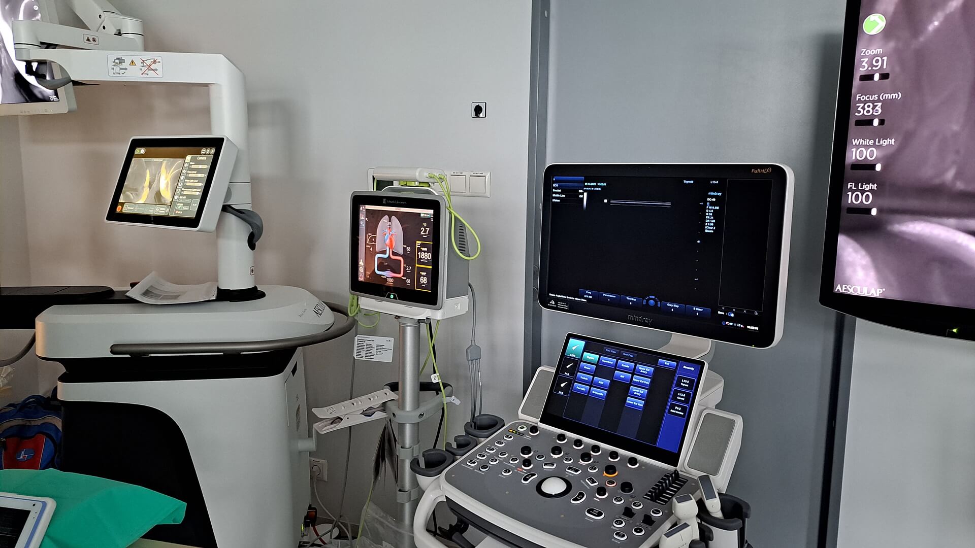 Uniwersytecki Szpital Kliniczny w Białymstoku kupił nowoczesny sprzęt do wykonywania operacji neurologicznych